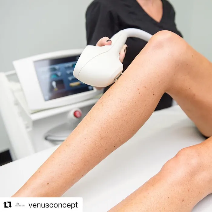 Laser Options by Jen LLC Picture 9