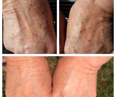 Laser Options by Jen LLC