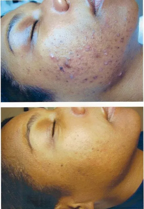 Skin Within Picture 10