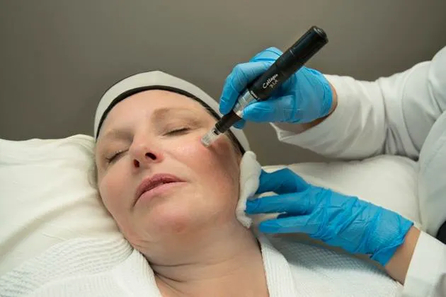 Skin Within Picture 2