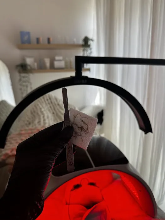 Fresh Face Aesthetics Picture 3