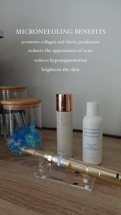 Fresh Face Aesthetics Picture 1