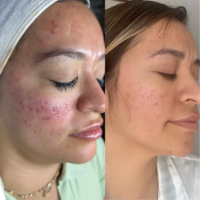 Skin Fairy Aesthetics Picture 9