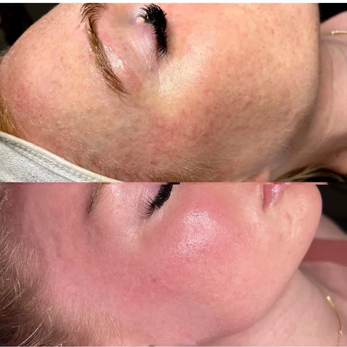 Skin Fairy Aesthetics Picture 2