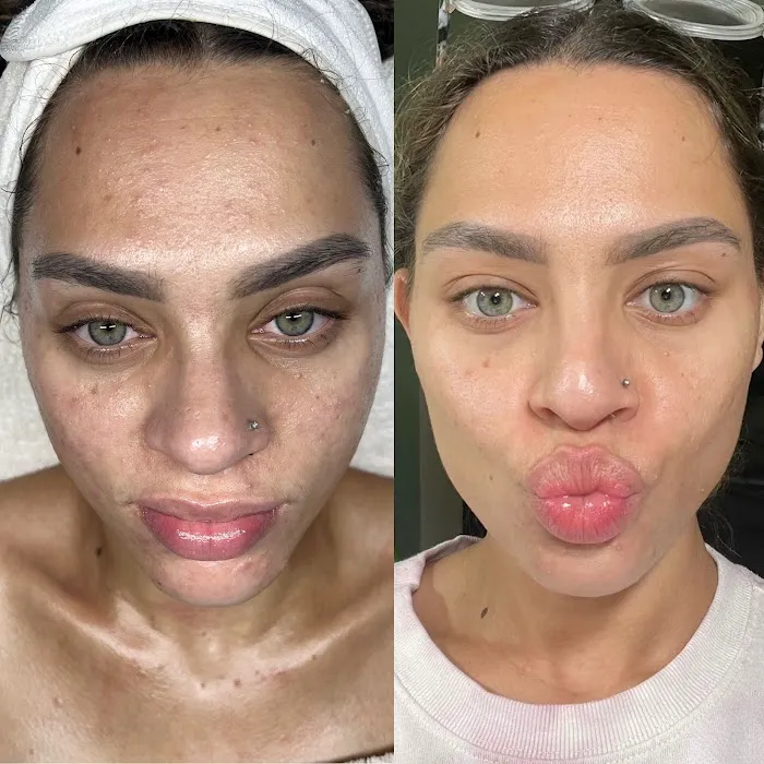 Skin Fairy Aesthetics Picture 4