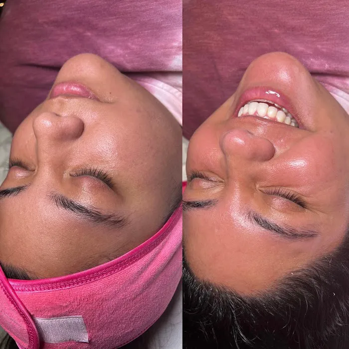 Skin Fairy Aesthetics Picture 6