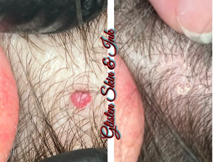 Glisten Skin & Ink Picture 2