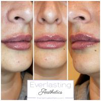 Everlasting Aesthetics ico