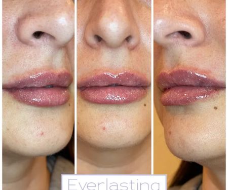 Everlasting Aesthetics