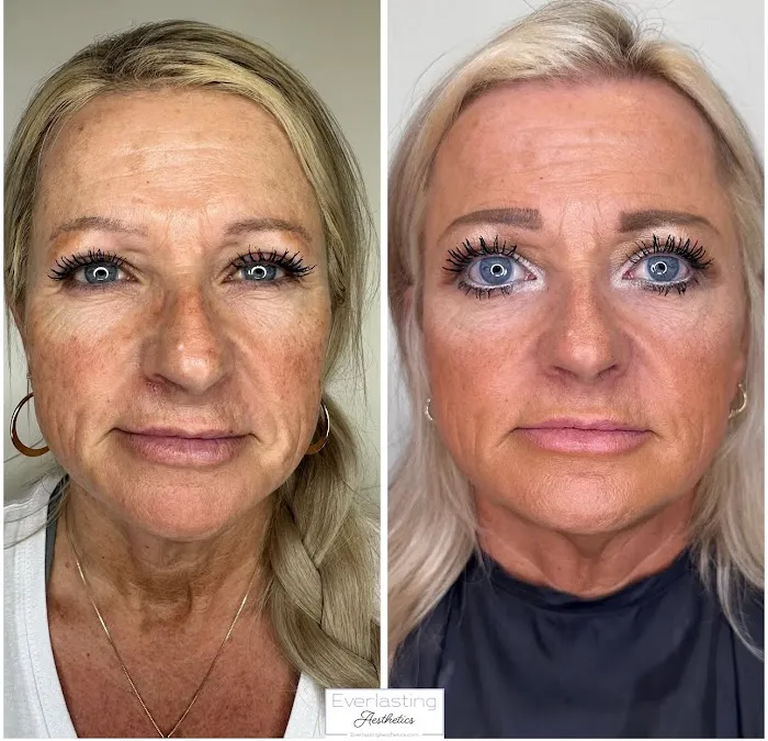 Everlasting Aesthetics Picture 6