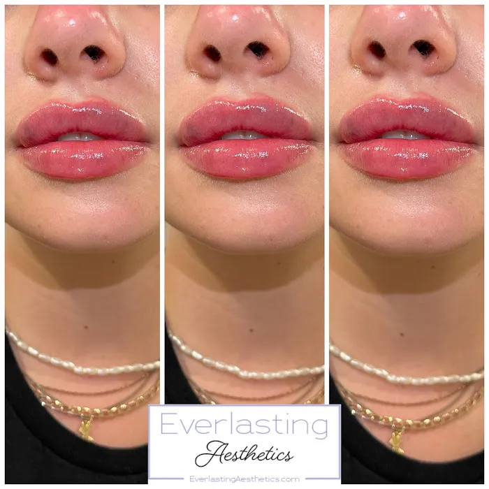 Everlasting Aesthetics Picture 4