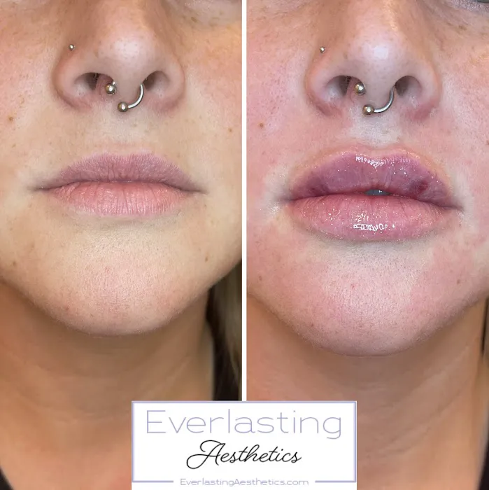 Everlasting Aesthetics Picture 5