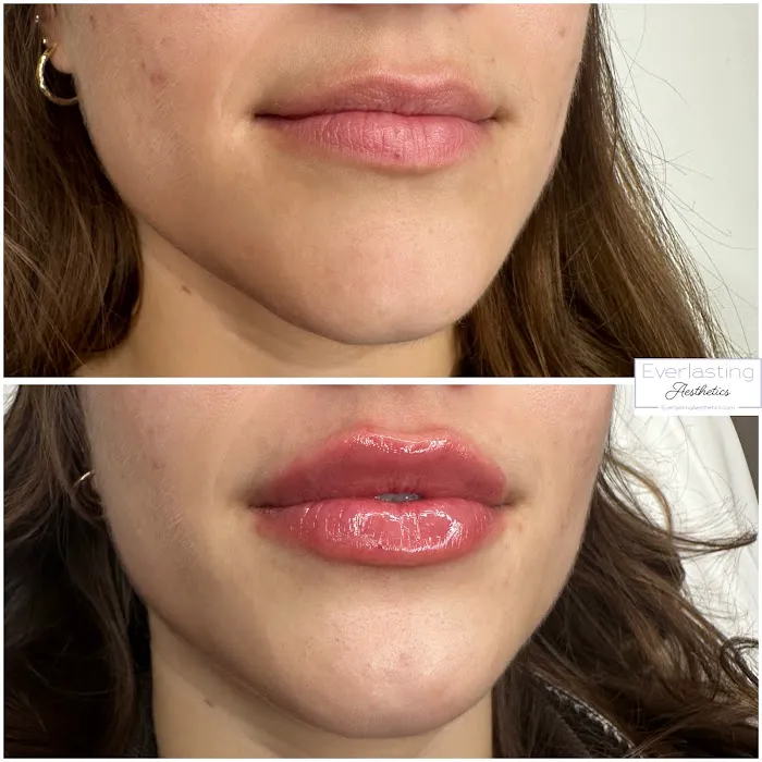 Everlasting Aesthetics Picture 2