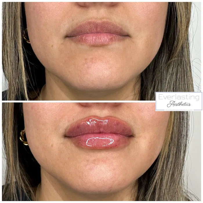 Everlasting Aesthetics Picture 9