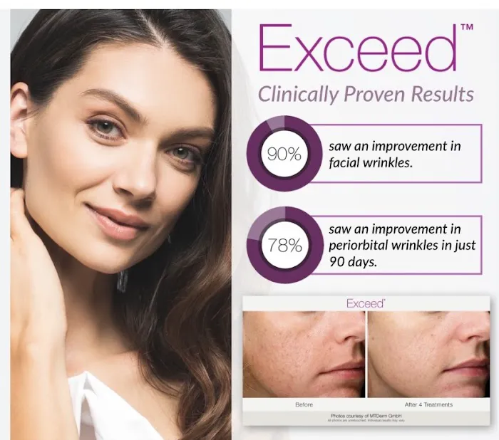 Classic Complexion Aesthetics Picture 3