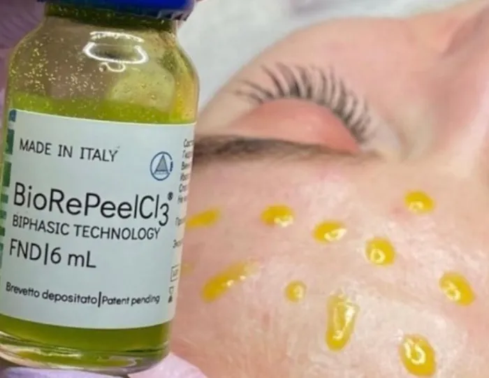 Classic Complexion Aesthetics Picture 10