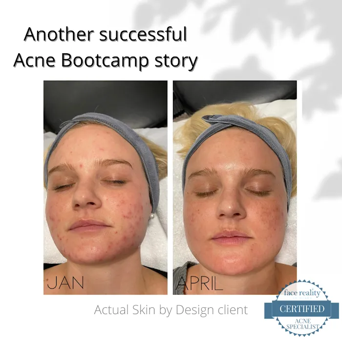 Skin by Design Picture 10