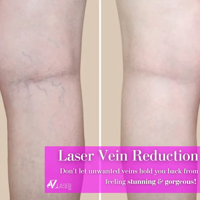 AZ Laser RX & Med Spa Picture 8