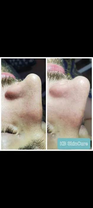 KB SkinCure Picture 2