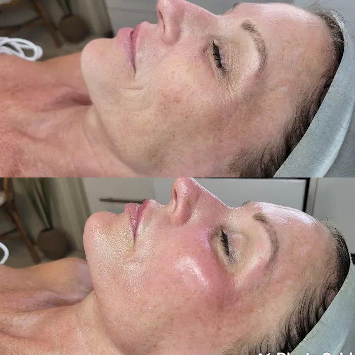 KB SkinCure Picture 7