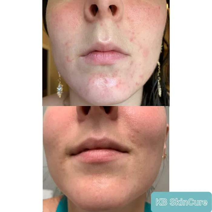 KB SkinCure Picture 8