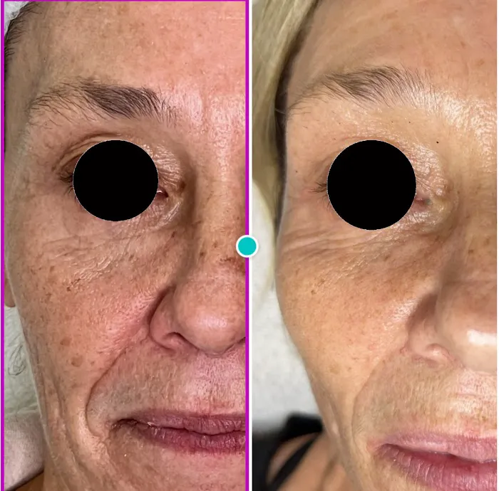 VeliCutis Picture 10