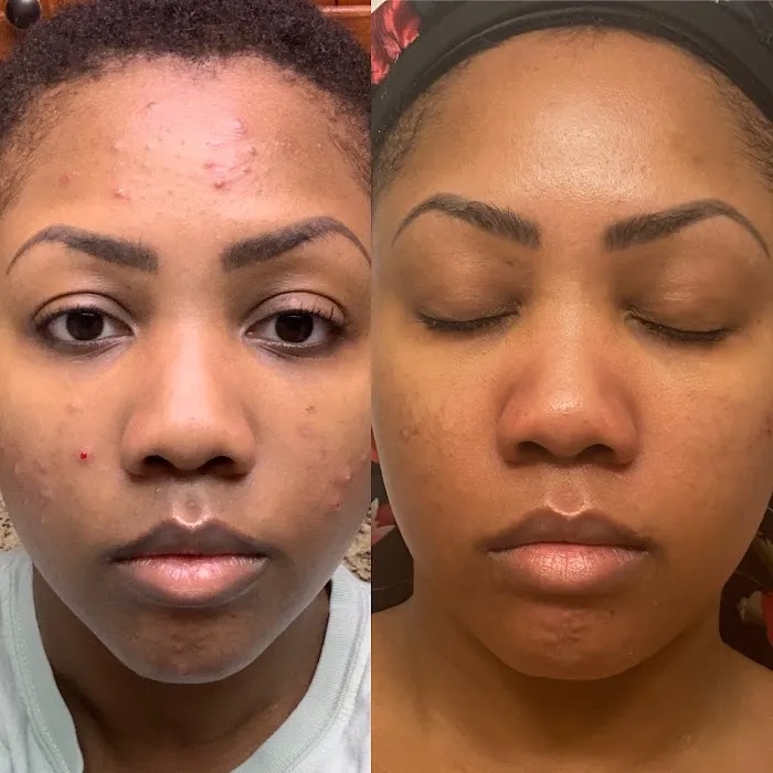 The Skin Routine Picture 3