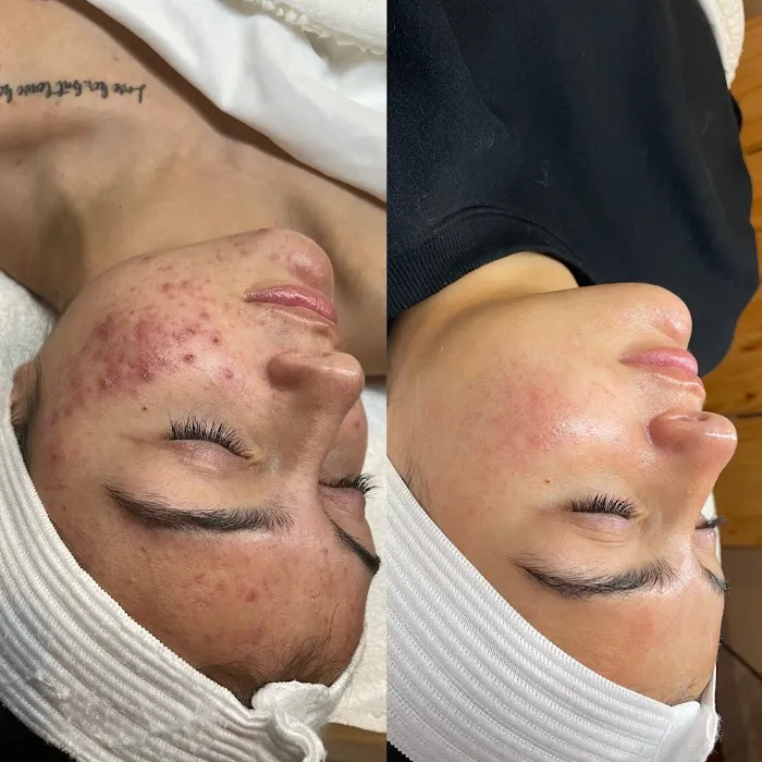 The Skin Routine Picture 7