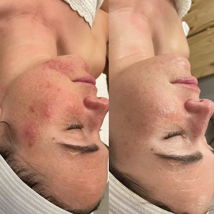 The Skin Routine Picture 6