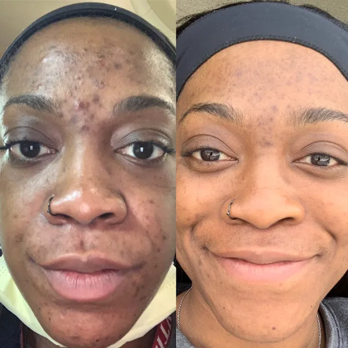 The Skin Routine Picture 2