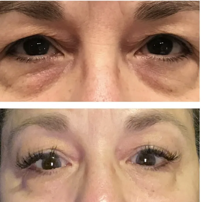 A Savvy Skin Care Picture 4