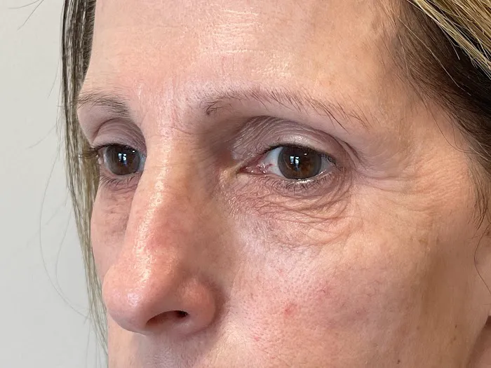 Luxury SkinFix Picture 2