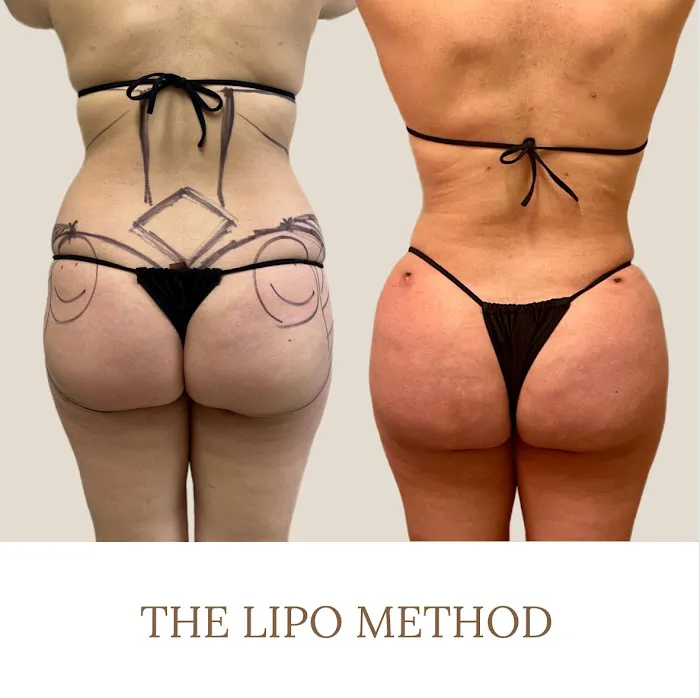 The Glow Method Skin Bar Picture 1