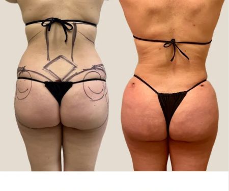 The Glow Method Skin Bar