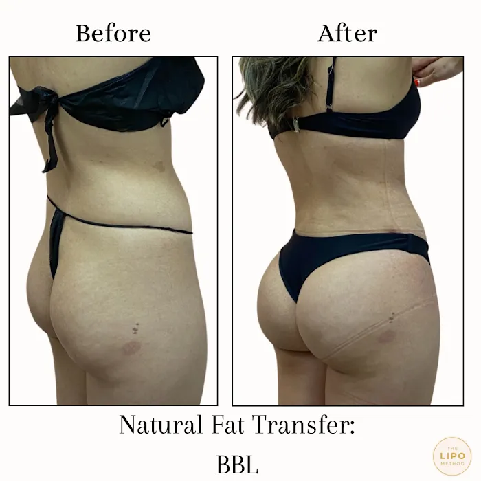 The Glow Method Skin Bar Picture 7