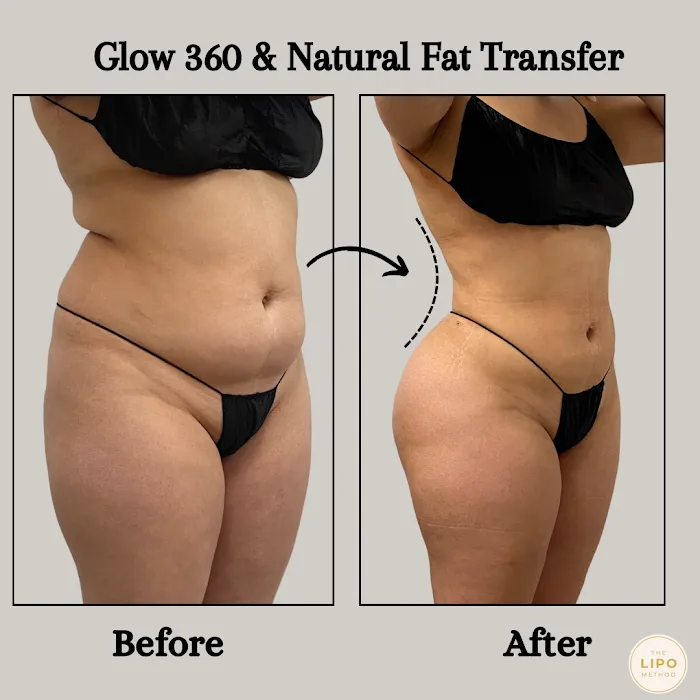 The Glow Method Skin Bar Picture 8