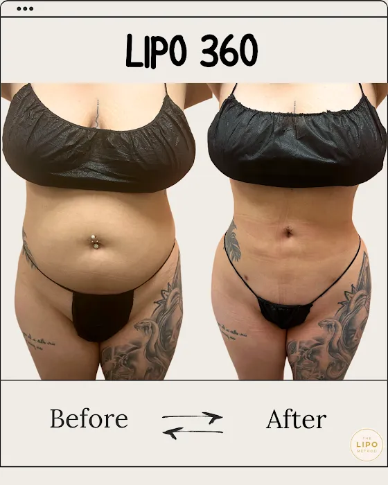 The Glow Method Skin Bar Picture 3