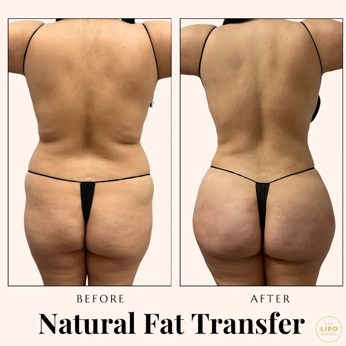 The Glow Method Skin Bar Picture 10