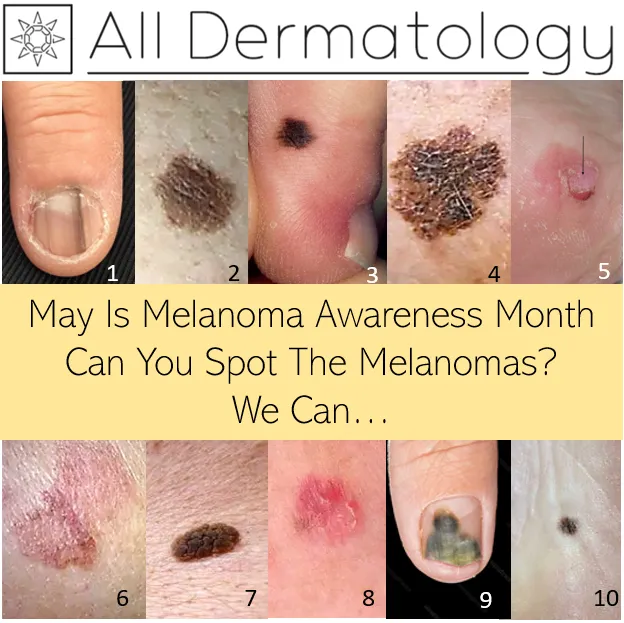 All Dermatology Picture 7