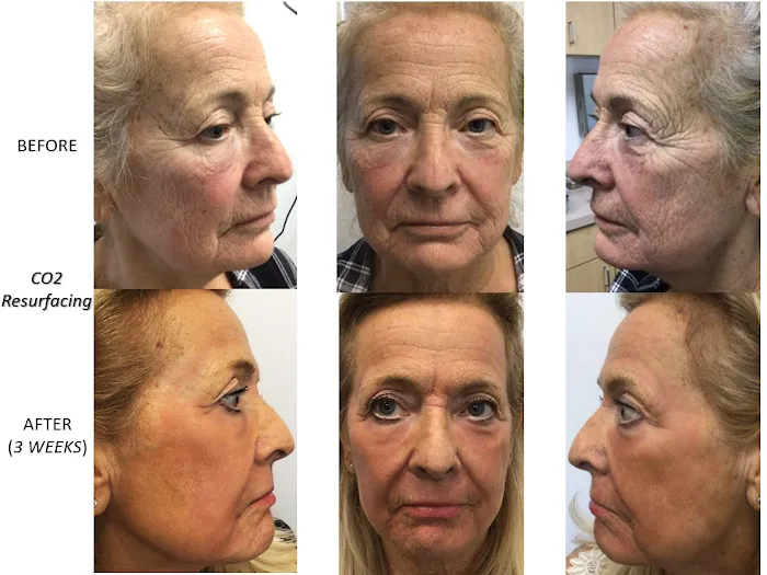 All Dermatology Picture 8