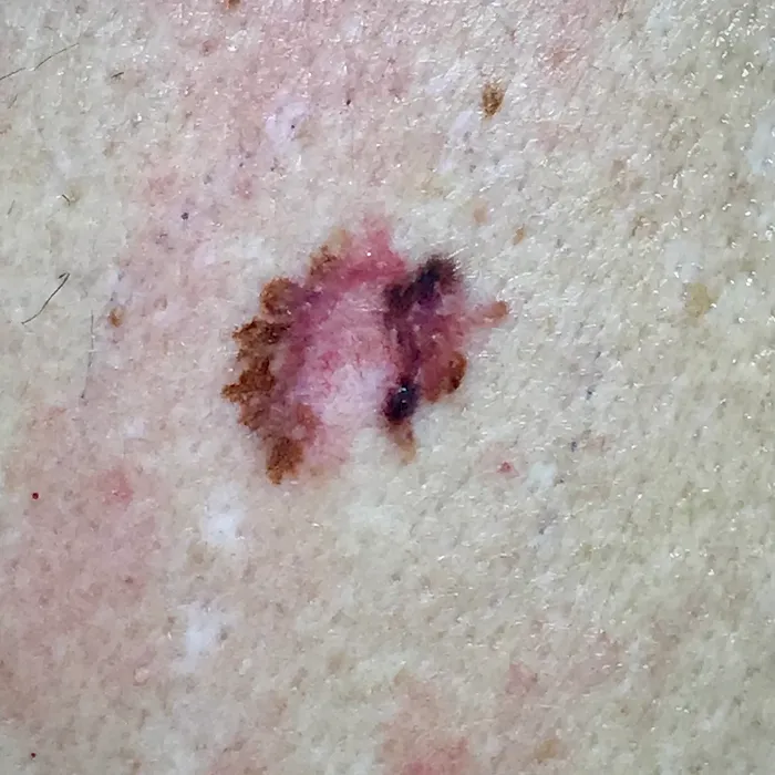All Dermatology Picture 10