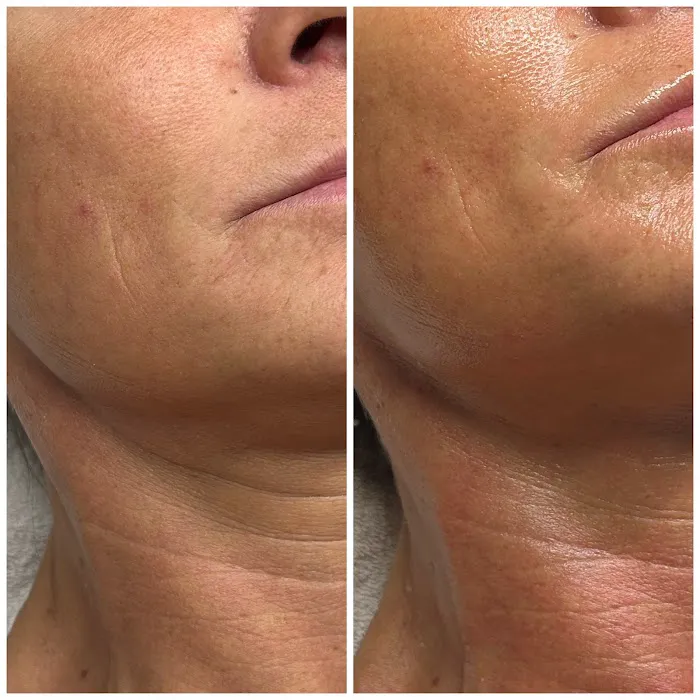 Foxy Glow Aesthetics Picture 3