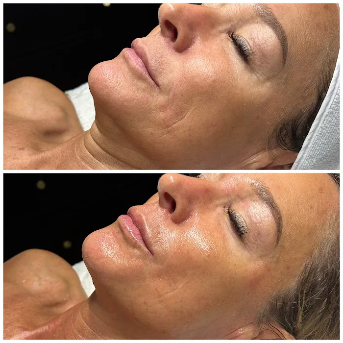 Foxy Glow Aesthetics Picture 2