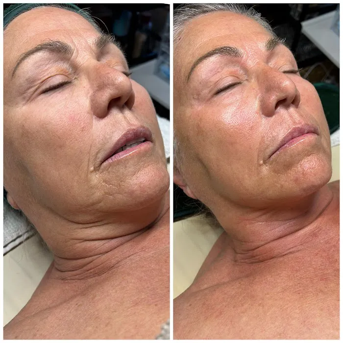 Foxy Glow Aesthetics Picture 9