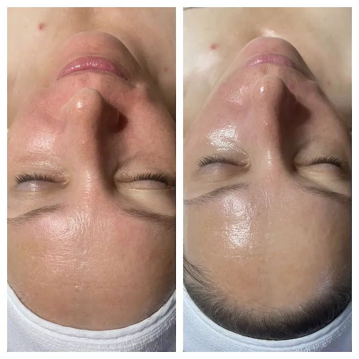 Foxy Glow Aesthetics Picture 5