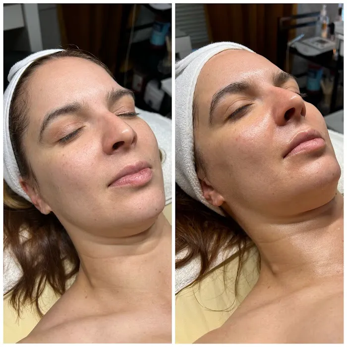 Foxy Glow Aesthetics Picture 4