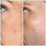 Foxy Glow Aesthetics