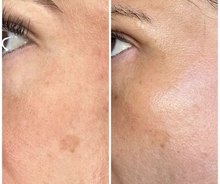 Foxy Glow Aesthetics