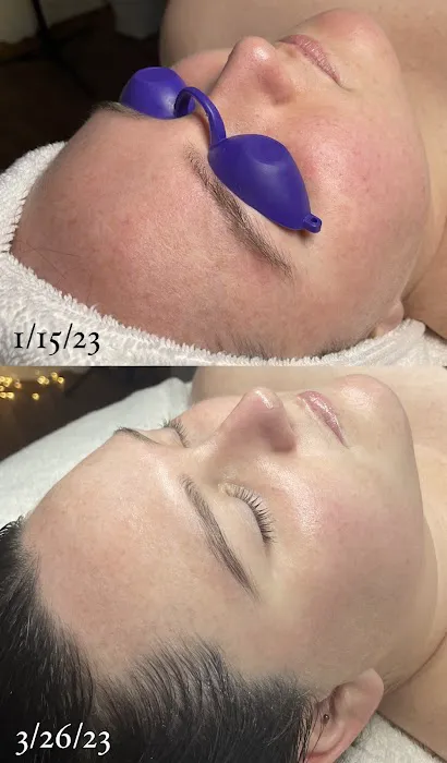 Sun & Moon Skin Picture 1