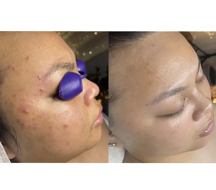 Sun & Moon Skin Picture 5